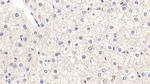 AFP Antibody in Immunohistochemistry (Paraffin) (IHC (P))