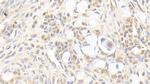 AFP Antibody in Immunohistochemistry (Paraffin) (IHC (P))