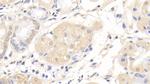 AFP Antibody in Immunohistochemistry (Paraffin) (IHC (P))