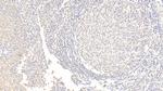 AFP Antibody in Immunohistochemistry (Paraffin) (IHC (P))