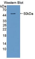 Aminoacylase Antibody in Western Blot (WB)