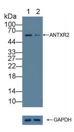 ANTXR2 Antibody in Western Blot (WB)
