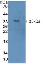 AZIN1 Antibody in Western Blot (WB)