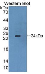 APOB Antibody in Western Blot (WB)