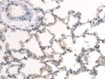 BMAL1 Antibody in Immunohistochemistry (Paraffin) (IHC (P))