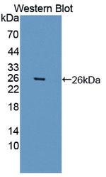 BMAL1 Antibody in Western Blot (WB)