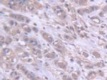 DARS Antibody in Immunohistochemistry (Paraffin) (IHC (P))