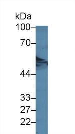 DARS Antibody in Western Blot (WB)