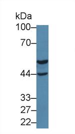 DARS Antibody in Western Blot (WB)