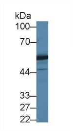 DARS Antibody in Western Blot (WB)