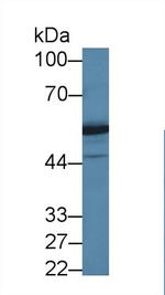 DARS Antibody in Western Blot (WB)