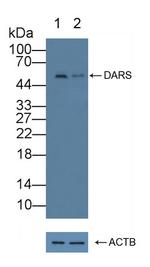 DARS Antibody in Western Blot (WB)