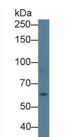 ABCA3 Antibody in Western Blot (WB)