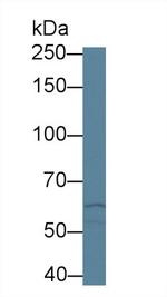 ABCA3 Antibody in Western Blot (WB)