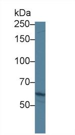 ABCA3 Antibody in Western Blot (WB)