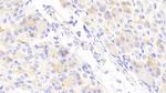 ABCD2 Antibody in Immunohistochemistry (Paraffin) (IHC (P))