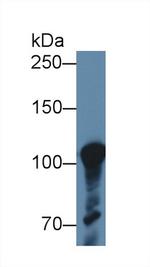 ABCF1 Antibody in Western Blot (WB)