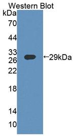 ABCF1 Antibody in Western Blot (WB)