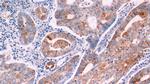 Bcl-2 Antibody in Immunohistochemistry (Paraffin) (IHC (P))