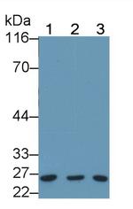 Bcl-2 Antibody in Western Blot (WB)