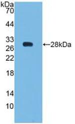 Bcl-2 Antibody in Western Blot (WB)
