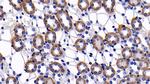 Bcl-2 Antibody in Immunohistochemistry (Paraffin) (IHC (P))