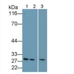 Bcl-2 Antibody in Western Blot (WB)