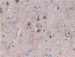 Beclin 1 Antibody in Immunohistochemistry (Paraffin) (IHC (P))