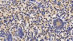 BID Antibody in Immunohistochemistry (Paraffin) (IHC (P))