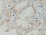 BLVRB Antibody in Immunohistochemistry (Paraffin) (IHC (P))