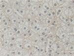 BLVRB Antibody in Immunohistochemistry (Paraffin) (IHC (P))