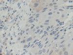 BLVRB Antibody in Immunohistochemistry (Paraffin) (IHC (P))