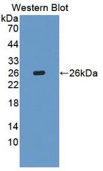 BLVRB Antibody in Western Blot (WB)