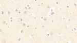 CaMKII gamma Antibody in Immunohistochemistry (Paraffin) (IHC (P))