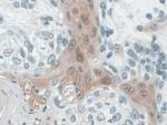 CALML5 Antibody in Immunohistochemistry (Paraffin) (IHC (P))