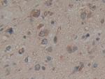 Calumenin Antibody in Immunohistochemistry (Paraffin) (IHC (P))