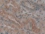 Calumenin Antibody in Immunohistochemistry (Paraffin) (IHC (P))