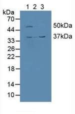 Calumenin Antibody in Western Blot (WB)