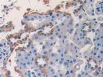 CK1 alpha Antibody in Immunohistochemistry (Paraffin) (IHC (P))