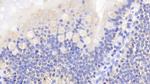 Caspase 2 Antibody in Immunohistochemistry (Paraffin) (IHC (P))