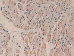 Caspase 3 Antibody in Immunohistochemistry (Paraffin) (IHC (P))