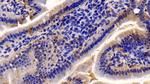 Caspase 7 Antibody in Immunohistochemistry (Paraffin) (IHC (P))