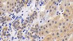 Caspase 8 Antibody in Immunohistochemistry (Paraffin) (IHC (P))