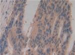 Caspase 8 Antibody in Immunohistochemistry (Paraffin) (IHC (P))