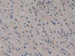 CARD9 Antibody in Immunohistochemistry (Paraffin) (IHC (P))