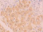 Catalase Antibody in Immunohistochemistry (Paraffin) (IHC (P))