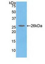 COMT Antibody in Western Blot (WB)