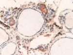 Cathepsin L Antibody in Immunohistochemistry (Paraffin) (IHC (P))