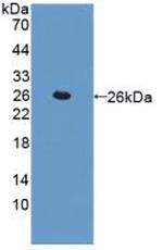 Cathepsin L Antibody in Western Blot (WB)