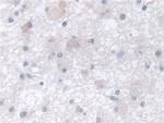 TCP-1 beta Antibody in Immunohistochemistry (Paraffin) (IHC (P))